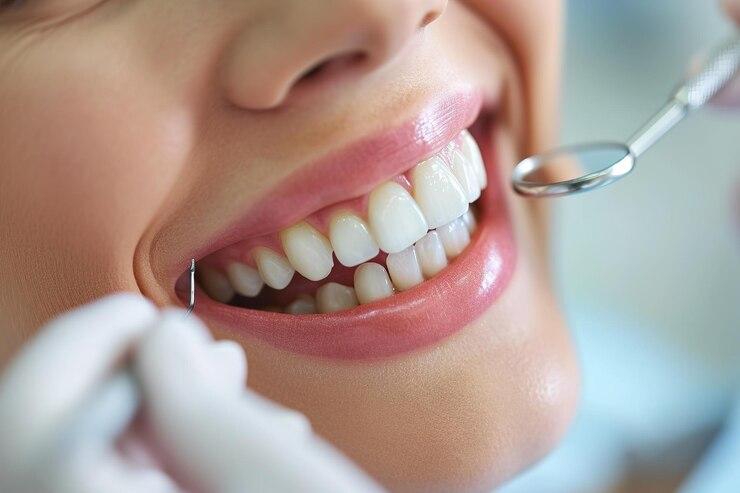 Dentist Supports